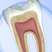 Endodontie | Centre Dentaire du Village de Ste-Dorothée | Laval